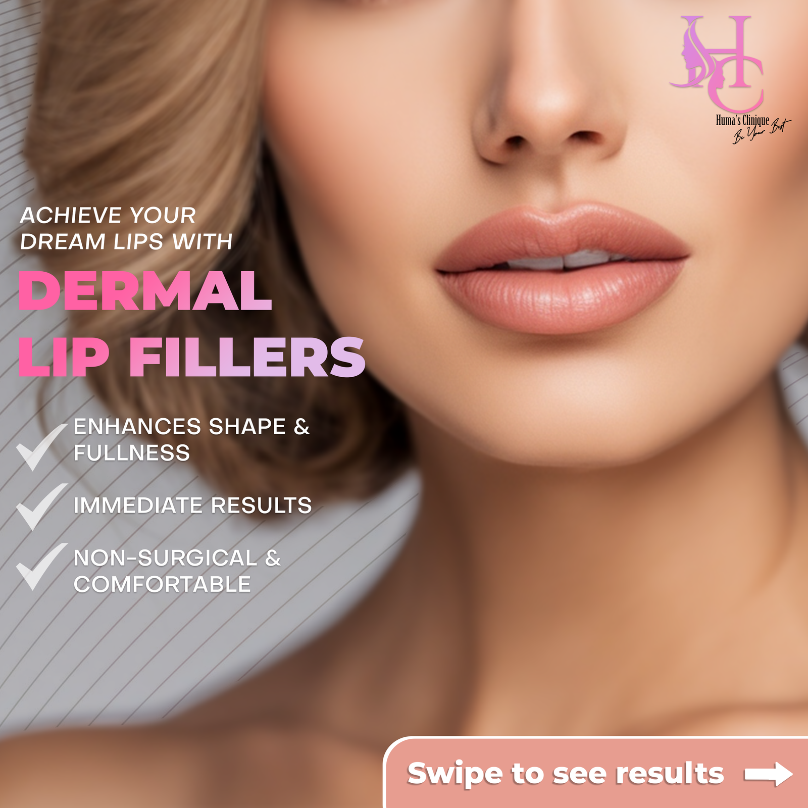 lip Filler post